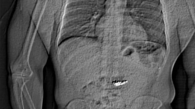 Polisi görən oğru oğurladığı brilyant sırğaları udub