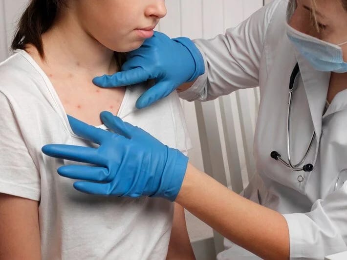 Qızılca geri döndü: Ümumdünya Səhiyyə Təşkilatından oyanış çağırışı