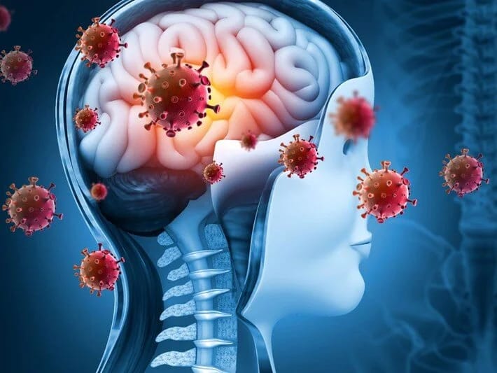 Monqolustanda ikinci meningit hadisəsi: Mütəxəssislər 7 əlamətə qarşı xəbərdarlıq edir