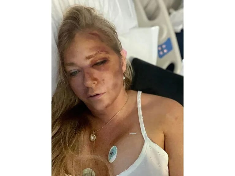 Milyarder Epsteynin qurbanı olan qadın qəza keçirdi: Bir neçə günüm qalıb