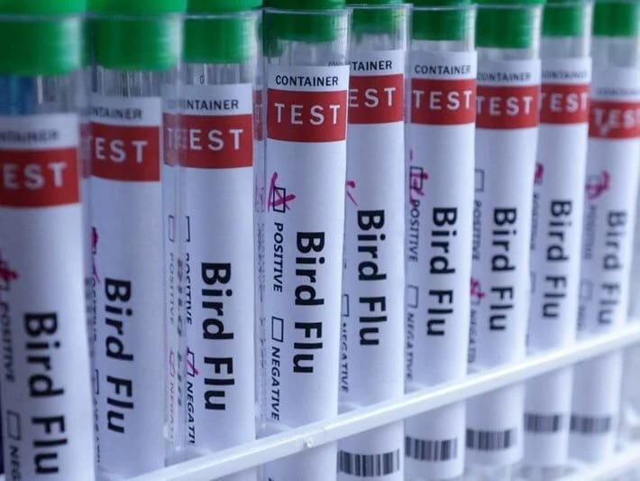 Meksikada H5N1-dən ilk ölüm aşkarlanıb