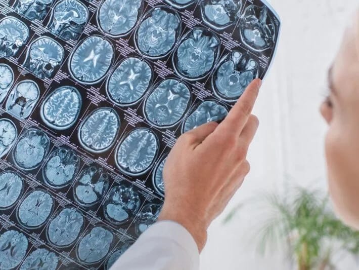 Kəlləsini qarnında gəzdirdi