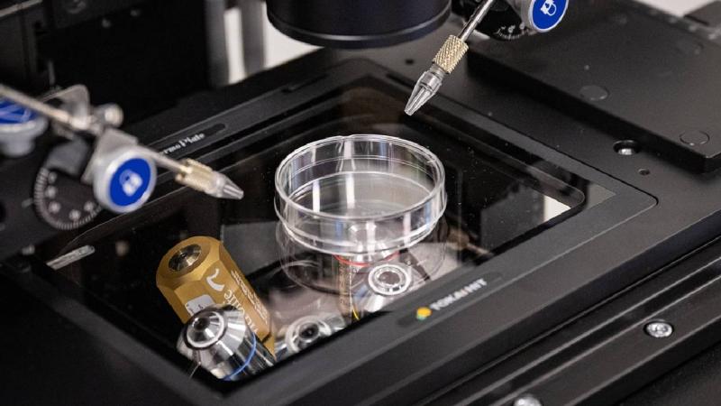 Avstraliyada süni mayalanma qalmaqalı: Başqasının körpəsini dünyaya gətirdi