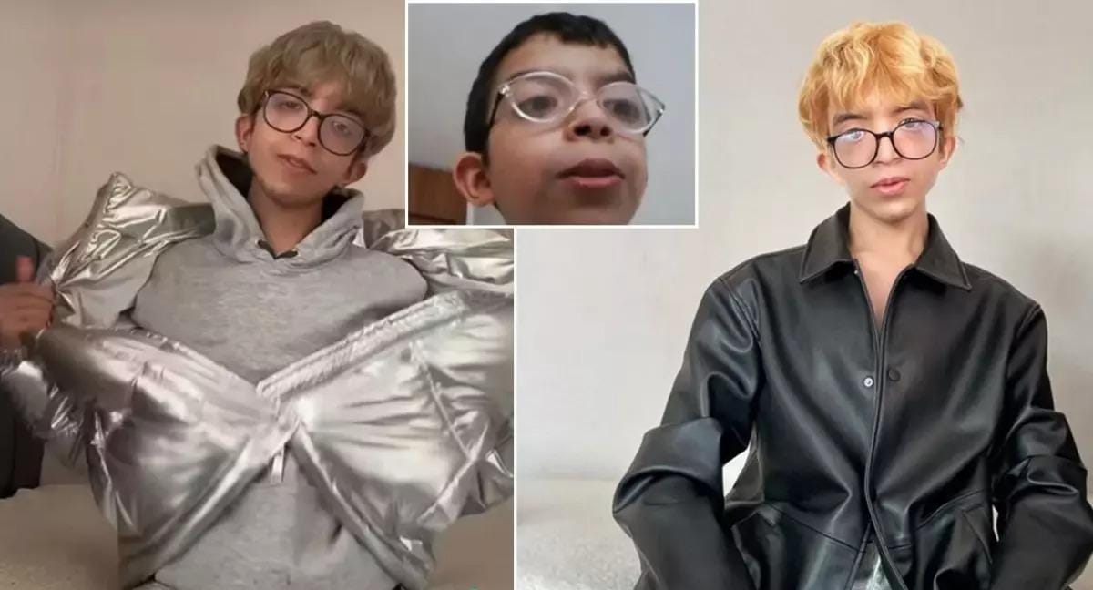 Türkiyəli fenomen cinsiyyətini dəyişdi