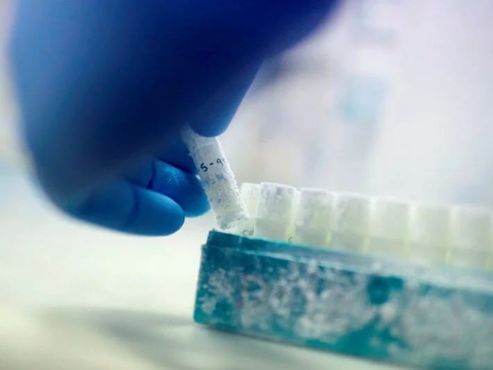 Tibbi fəlakət: 85 sperma donoru minlərlə uşaq atası oldu 