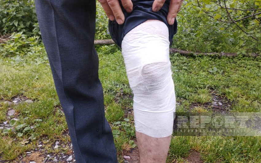 Oğuzda çaqqal 56 yaşlı kişiyə hücum edib