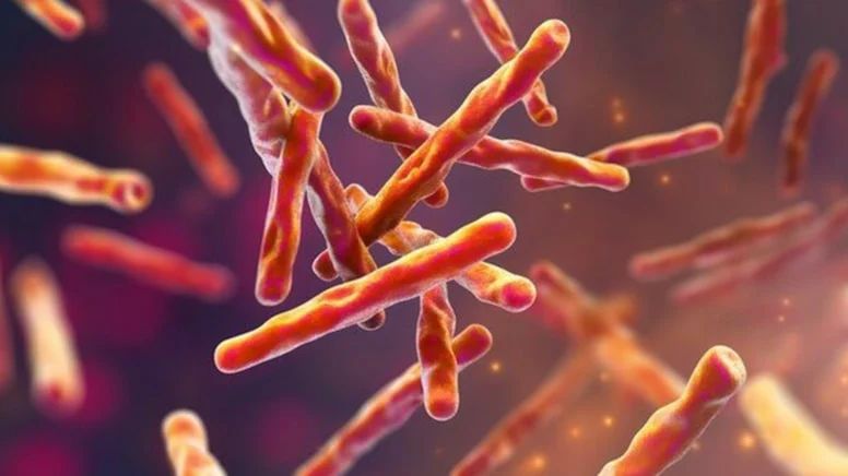 ABŞ-də vərəmə yoluxma halı aşkarlandı