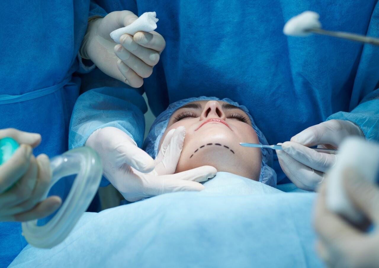 Əməliyyatla özünü pişiyə bənzətdi - VİDEO