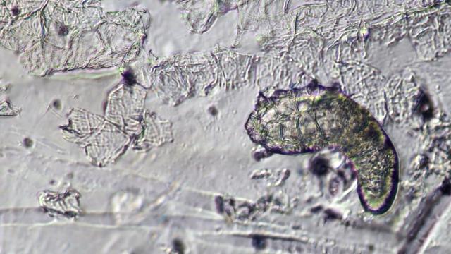 Yatarkən üzünüzdə yaşayan canlılar iş başında ola bilər