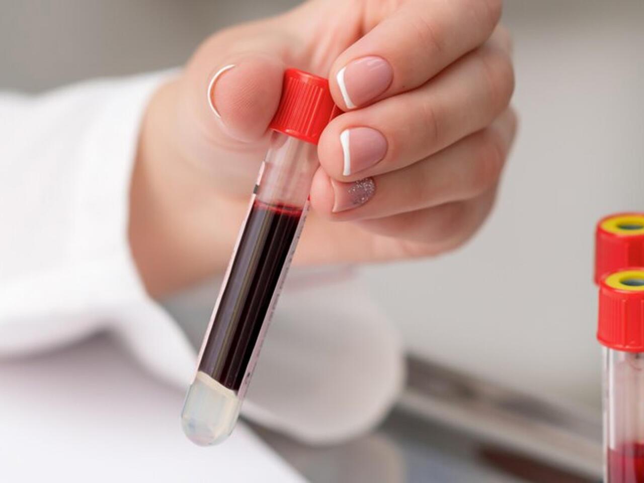 Bütün qan qruplarına uyğun gələn süni qan hazırlandı