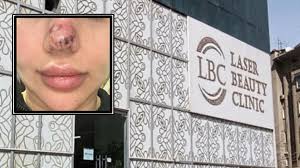 Rəna Soltanovanın daha bir qurbanı danışdı: 