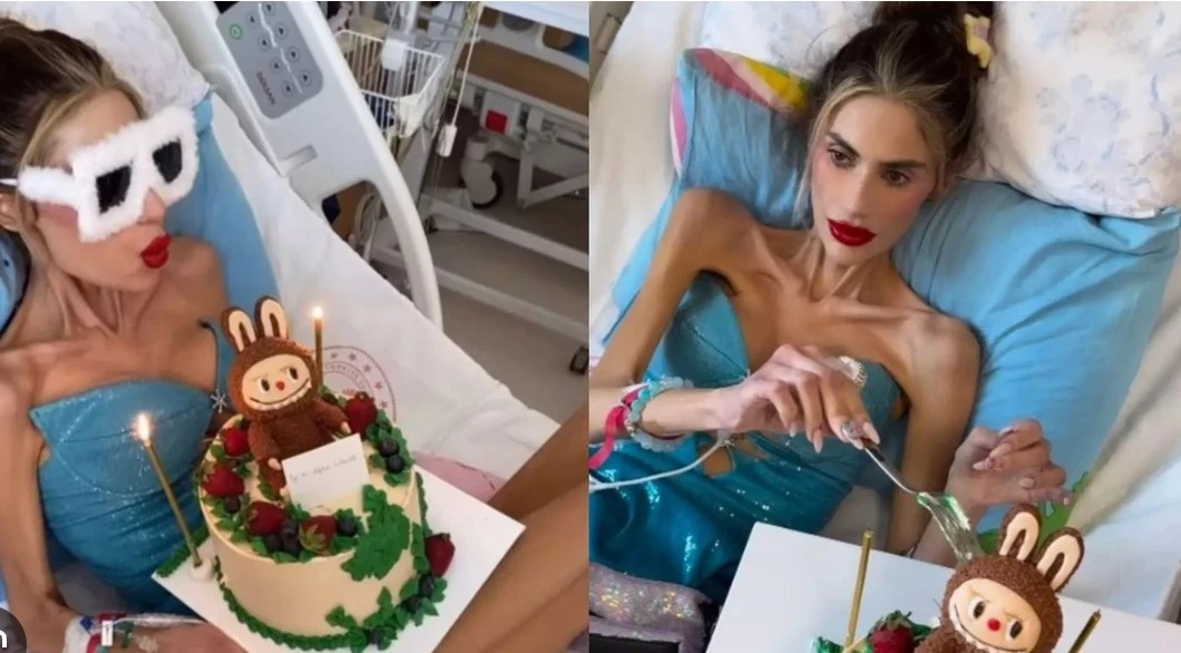 Anoreksiya xəstəsi olan fenomen daha 1 kilo arıqladı