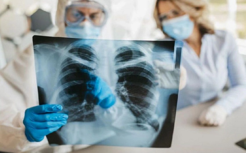 Qobustan Regional Xəstəxanasında 160 vərəm xəstəsi qeydiyyatdadır