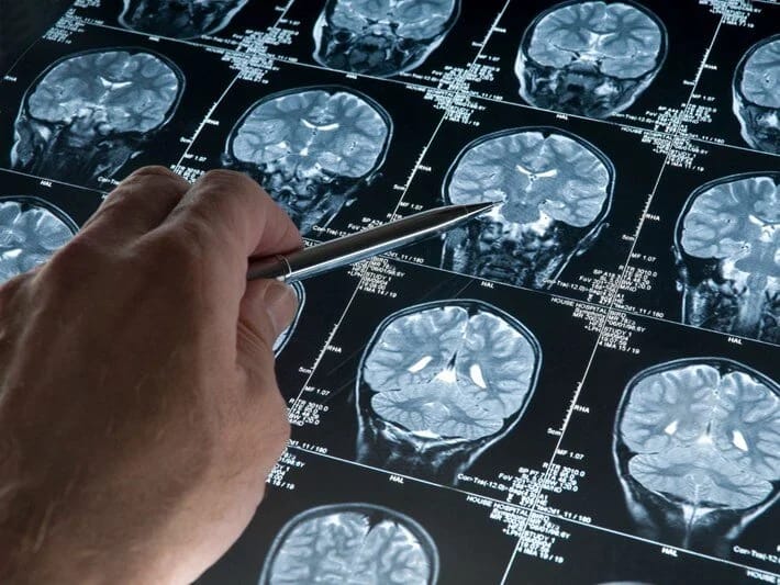 İnsan beyni işıq saçır