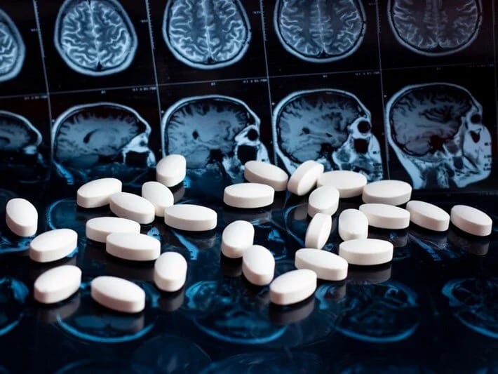 Alzheimerə qarşı gündə bir həb insanlar üzərində sınaqdan keçiriləcək