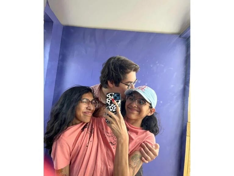 Bitişik əkizlərin qeyri-adi toyu: Biri evləndi, digəri qarşı çıxdı