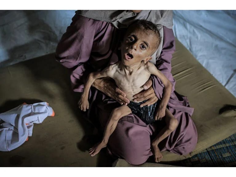 Səssiz qiyamət: Dünyanın gözü qarşısında acından ölürlər