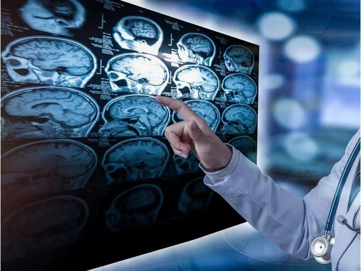 Xatirələrimiz sabit deyil: Beyin eyni hadisəni hər dəfə fərqli şəkildə qeyd edir