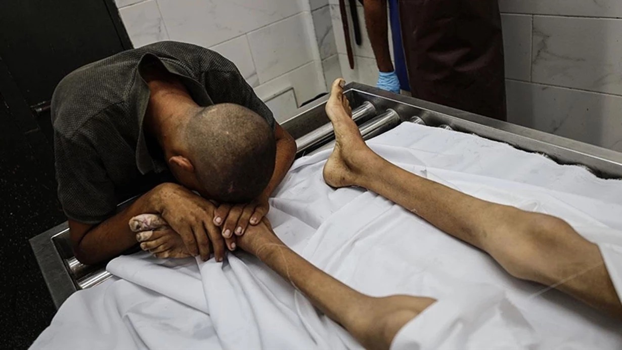 Qəzzada aclıqdan ölənlərin sayı 180-ə çatdı