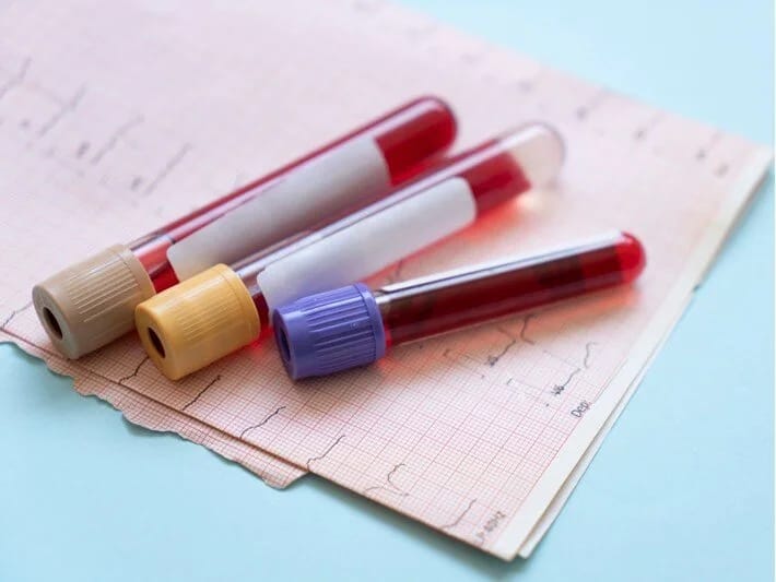 100 yaş görmənin sirri qan dəyərlərində gizlidir