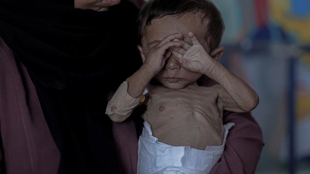 Daha bir uşaq tibbi çatışmazlıq səbəbindən ölüb