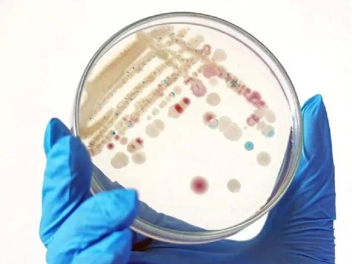 Ət yeyən bakteriyalar 9 nəfəri öldürdü