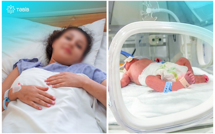 TƏBİB: Metroda doğulan körpə süni tənəffüs aparatına qoşulub