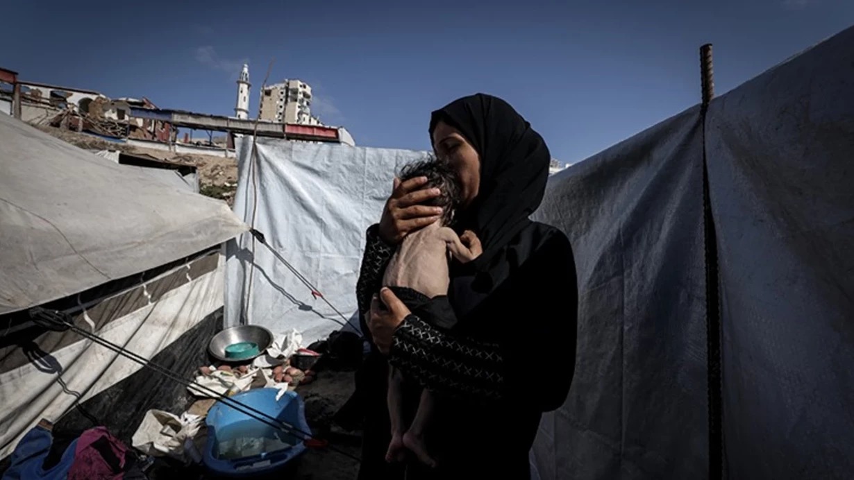 Qəzzada aclıqdan ölənlərin sayı 300-ə çatdı