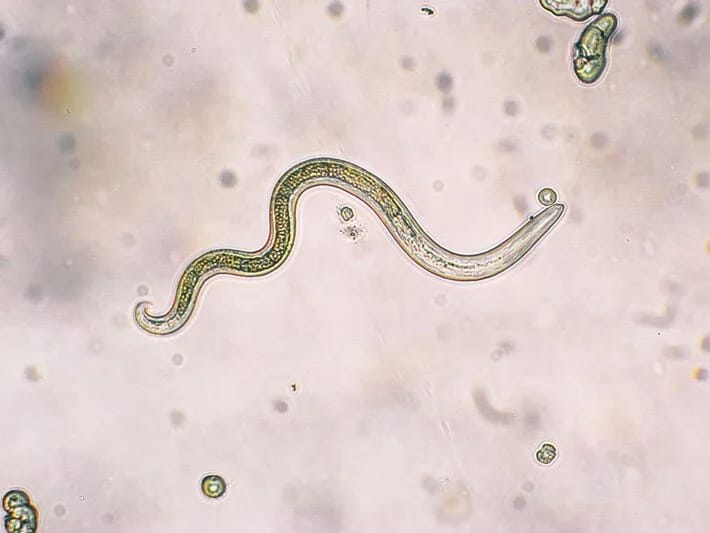 Parazitin gizli sirri: Bədənə nüfuz edir və ağrı hiss edən sinirləri bağlayır