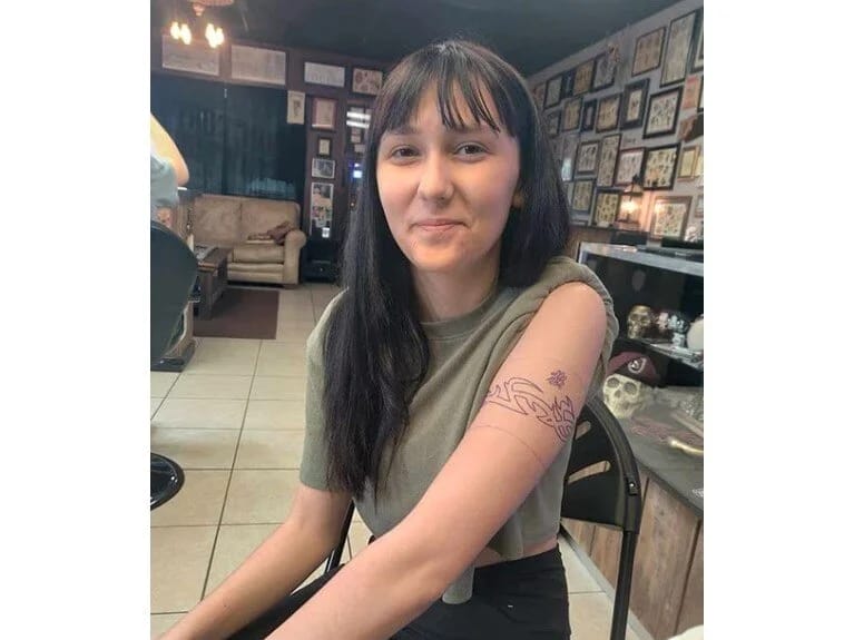 Saçını boyadı, amma sonu faciə ilə bitdi: 18 yaşlı qızın başında dəlik yarandı 