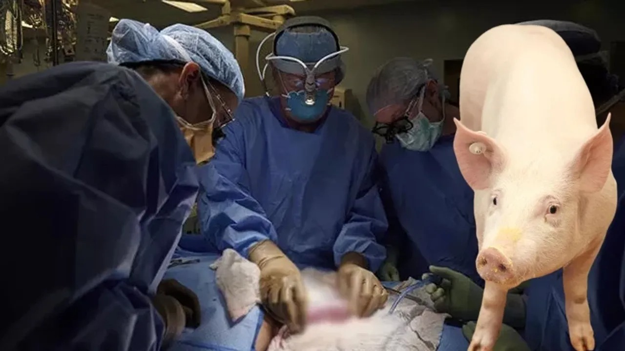 Dünyada ilk dəfə donuzdan insana ağciyər transplantasiyası həyata keçirilib