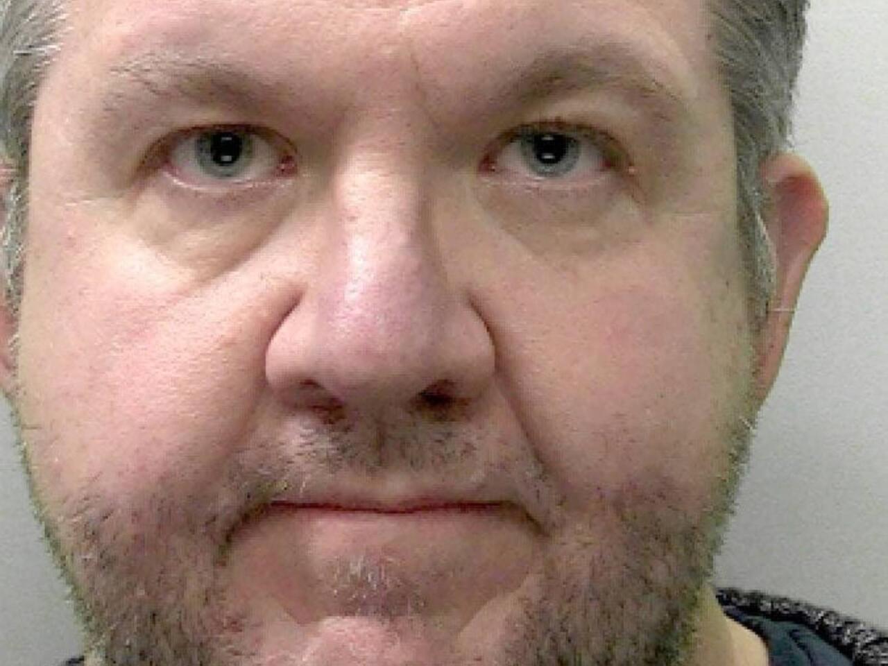 Cərrah sığortadan pul almaq üçün öz ayaqlarını amputasiya etdi - FOTO