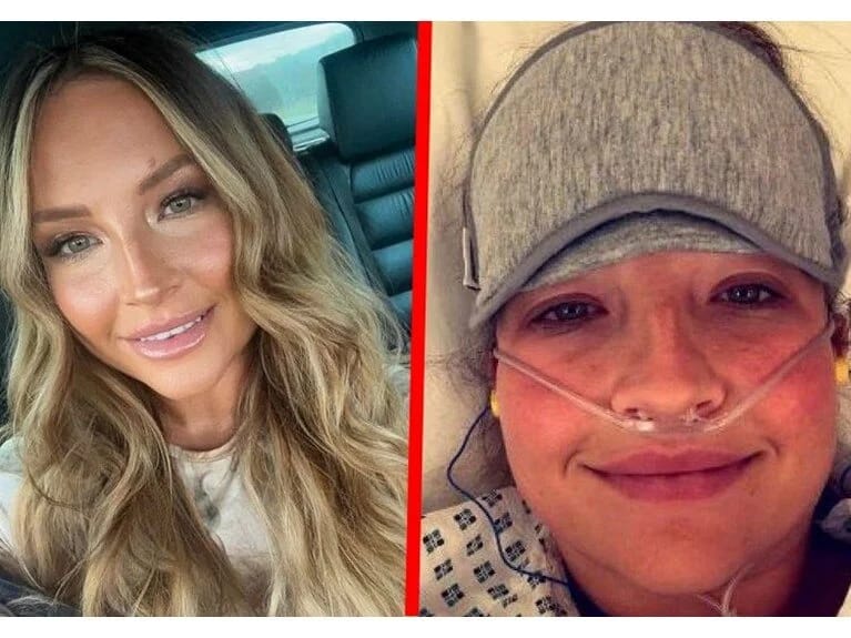 Həkimlər ona əzələ ağrısı dedi, gənc qız ayağının amputasiyası ilə üzləşib