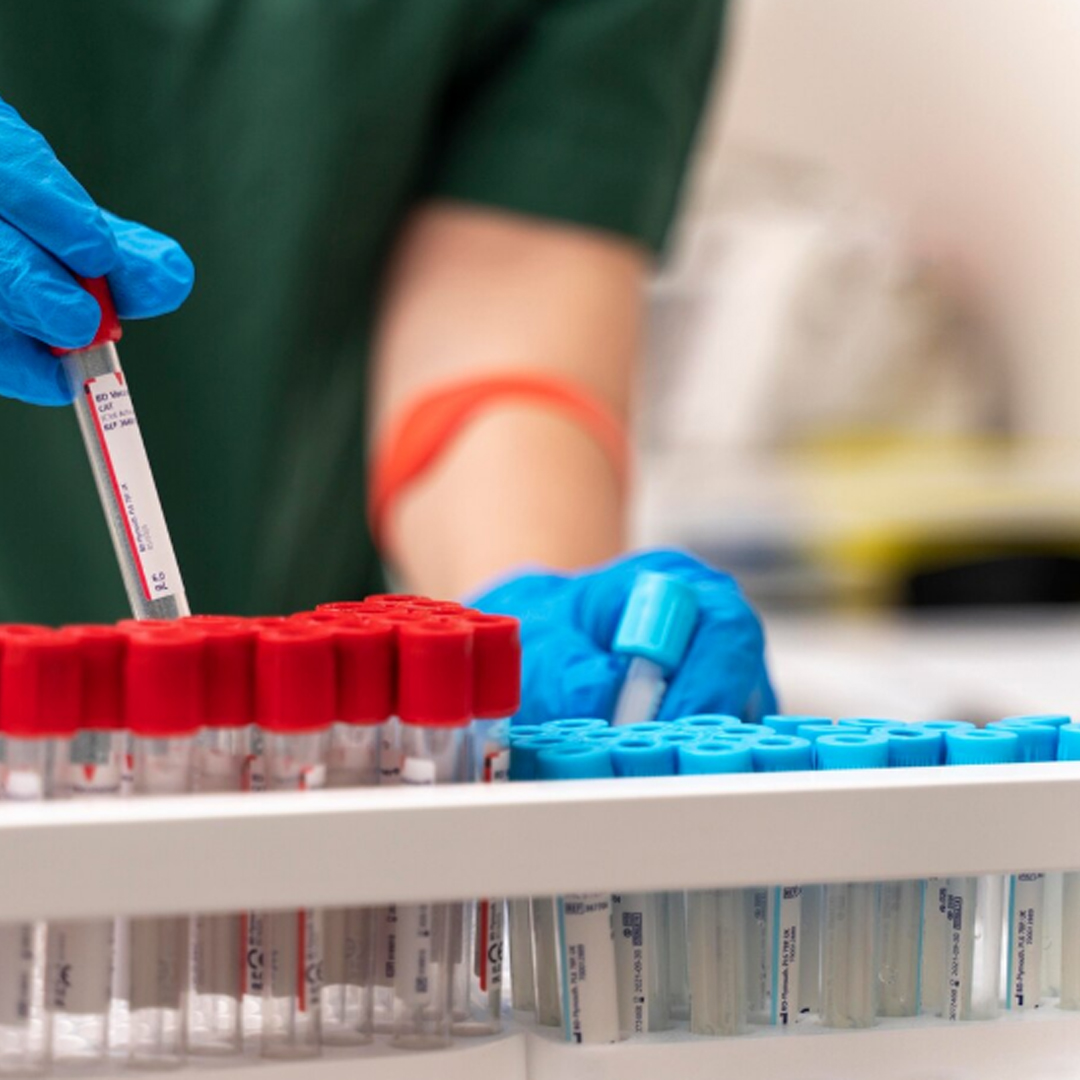 Narkomanların İİV-ə yeni yoluxma hadisələrinin sayında azalma müşahidə olunur