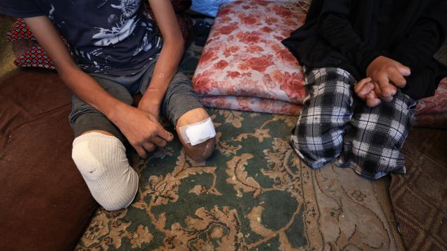 BMT komissarı: Oktyabrın 7-dən Qəzzada 4000 uşaq amputasiya edilib