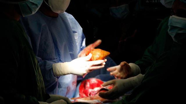 Bütün qan qruplarına uyğun universal böyrək hazırlandı