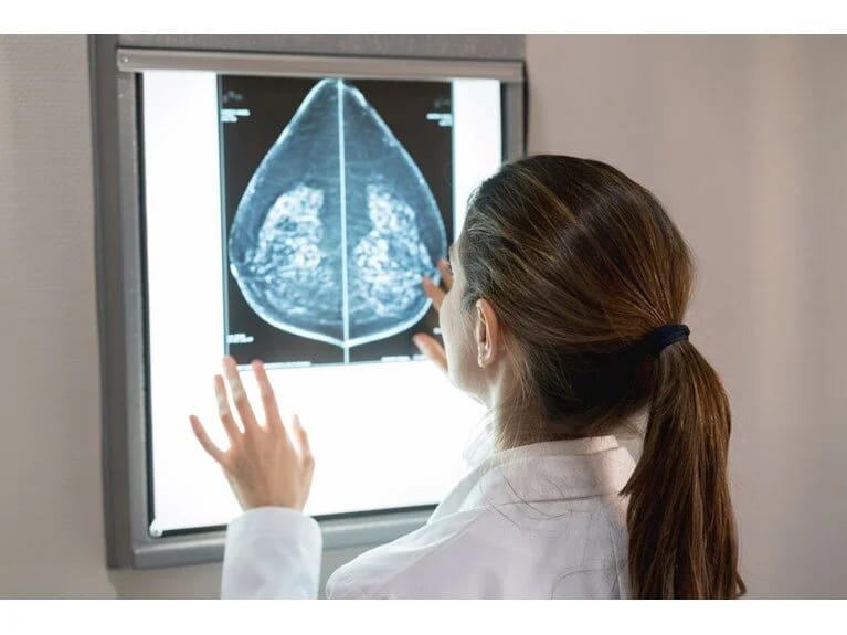 Döş xərçəngi müalicəsində perspektivli inkişaf