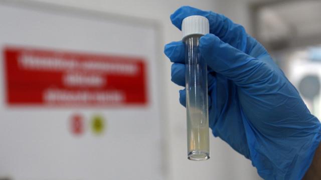 ÜST: 2024-cü ildə 1,2 milyondan çox insan vərəmdən öldü