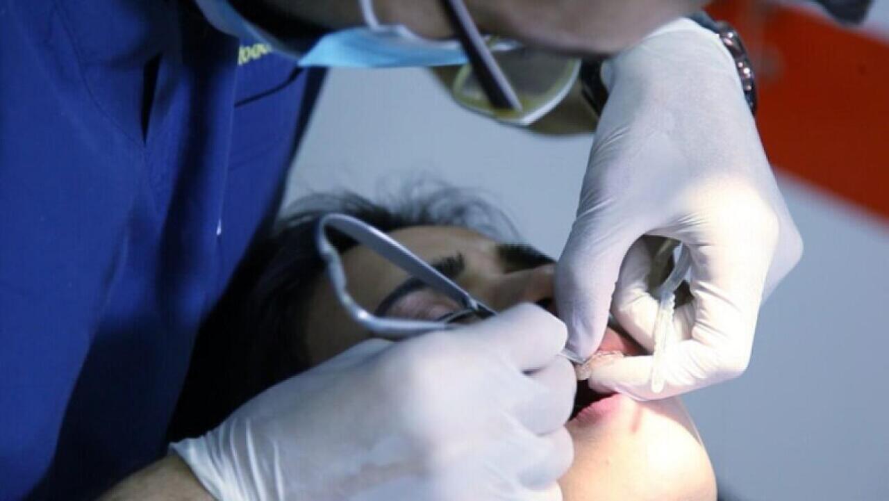 TƏBİB stomatoloqlara xəbərdarlıq etdi - Tədbir görüləcək