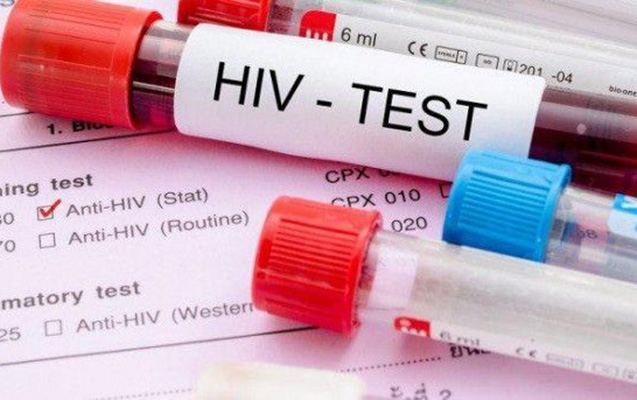 Azərbaycanda İİV-lə yaşayanların sayı açıqlanıb