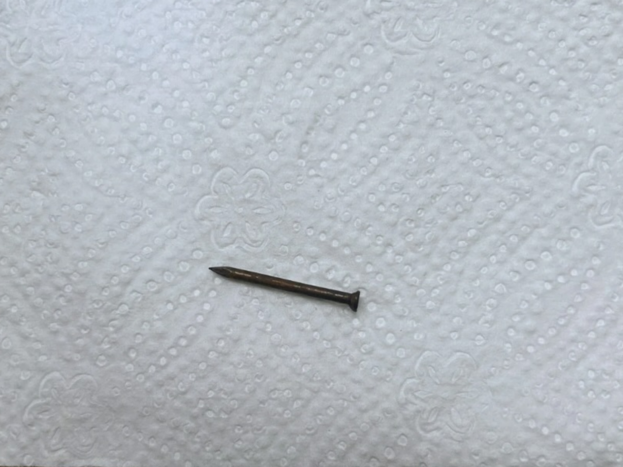 Bakıda azyaşlının mədəsindən mismar çıxarıldı - FOTO