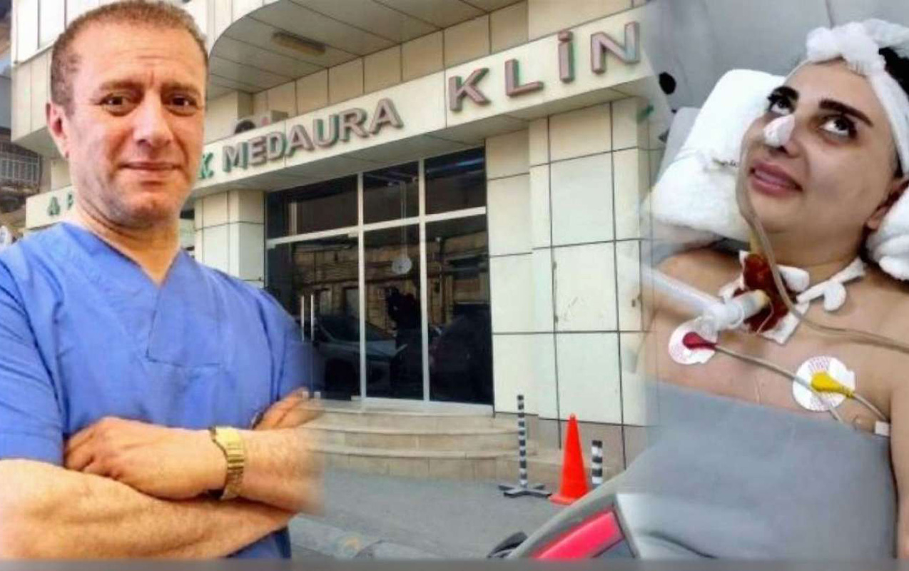 Komaya düşən Nigara görə həkimlərə cinayət işi açılıb - Fotolar