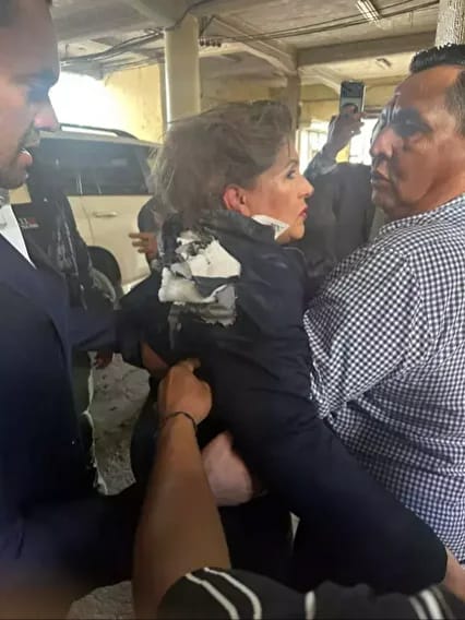 Hondurasda deputatın belində bomba partladı