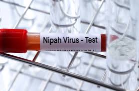 Nipah virusunu vaxtında müəyyənləşdirməyin yolları