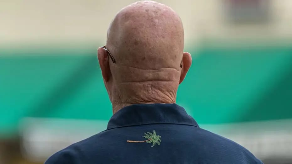 Tədqiqatçılar min illik bitkidə keçəlliyə çarə tapıblar