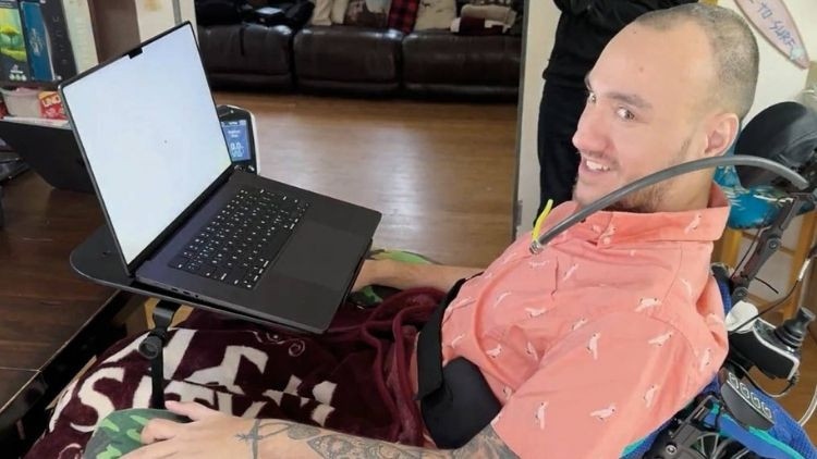 21 könüllü beyin çipi sınaqlarında iştirak edir