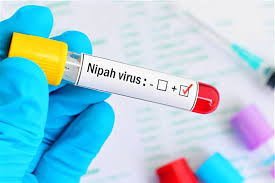 Banqladeşdə Nipah virusundan ilk ölüm hadisəsi qeydə alındı