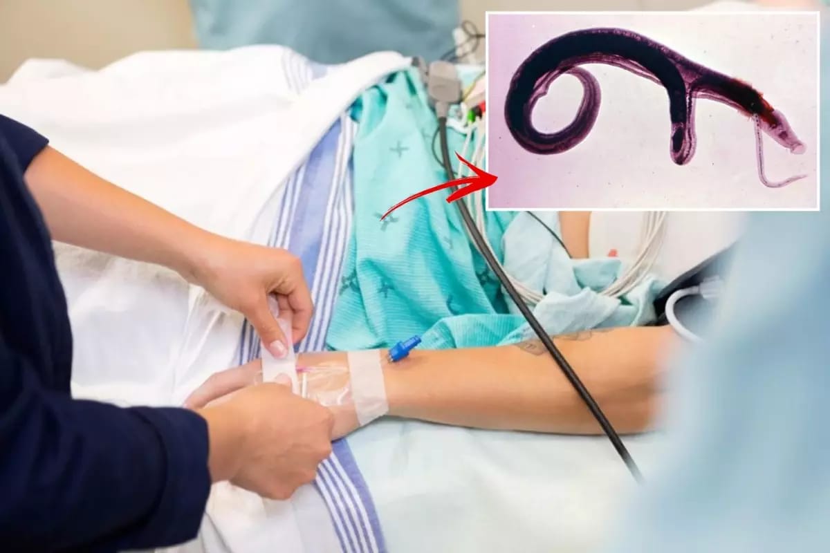 ÜST qlobal xəbərdarlıq edir: Genital parazit inkişaf edir və yeni ölkələrə yayıla bilər