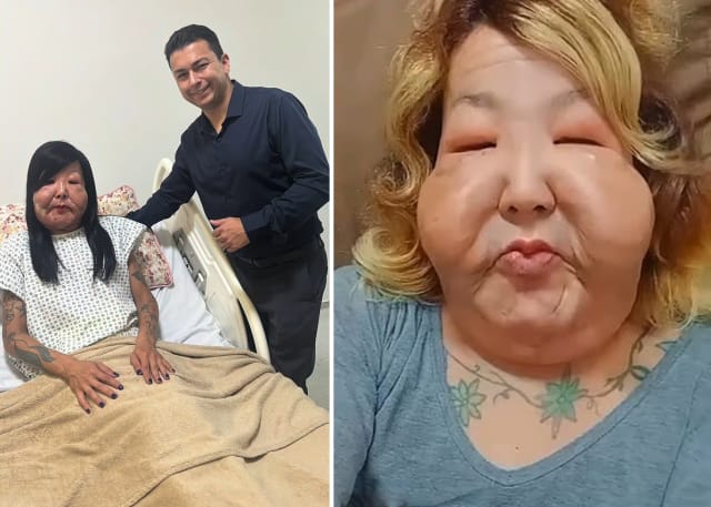 Üzünü gözəlləşdirmək istədi nəticə tərsinə oldu