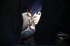 ABŞ-də taksi sürən həkimdən ŞOK ƏMƏL - Xəstənin dalağının əvəzinə qaraciyərini kəsdi - FOTO